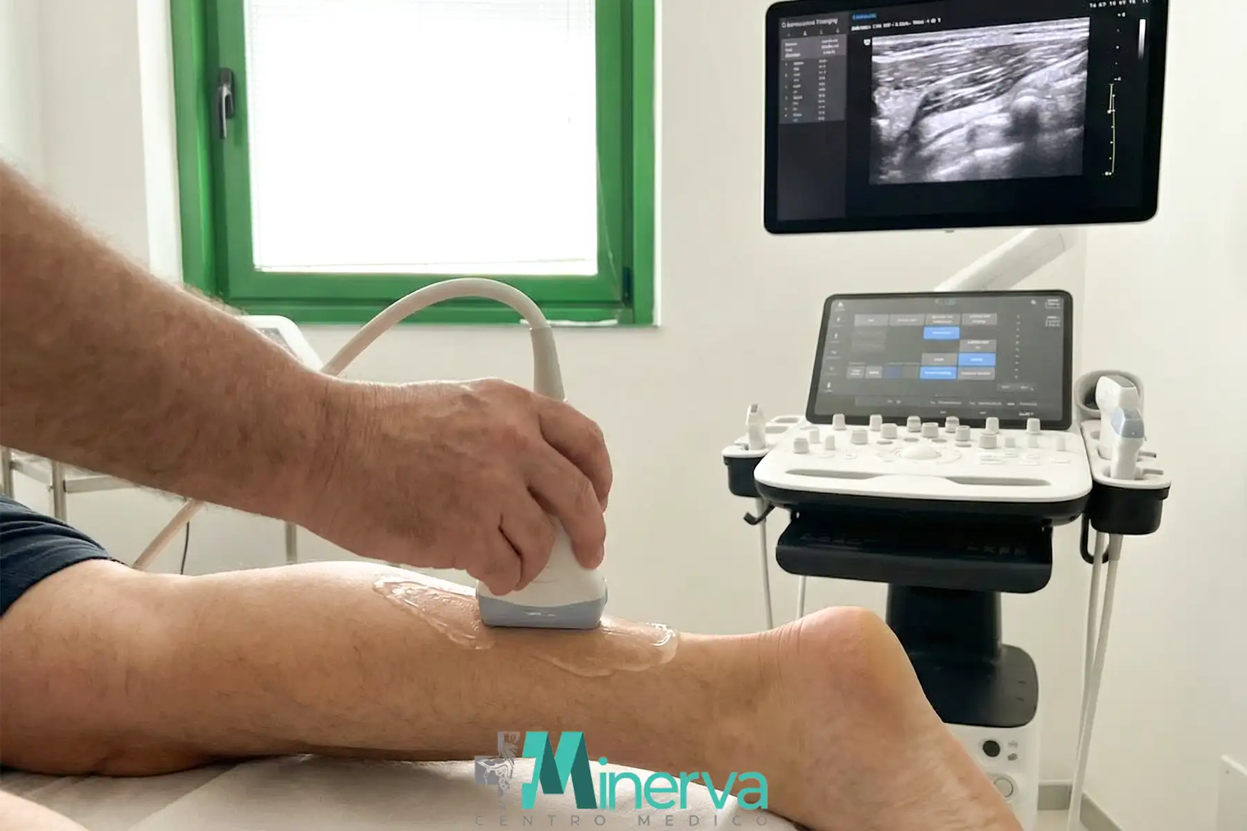 Ecografia Muscolo Tendinea a Savona