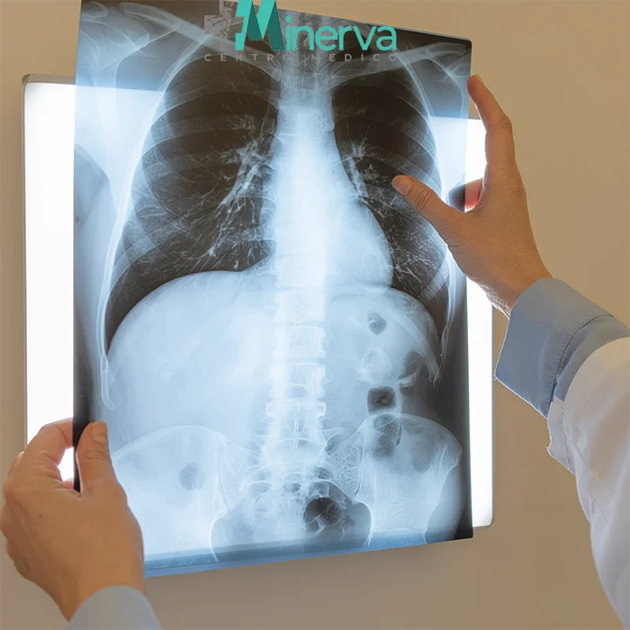 Radiografia toracica